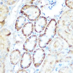 Anti-PCK2 antibody used in IHC (Paraffin sections) (IHC-P). GTX64476