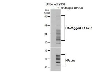 Anti-TXA2R antibody [HL4757] used in Western Blot (WB). GTX644761