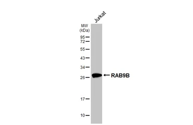 Anti-RAB9B antibody [HL4758] used in Western Blot (WB). GTX644762
