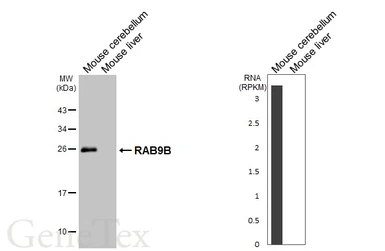 Anti-RAB9B antibody [HL4758] used in Western Blot (WB). GTX644762