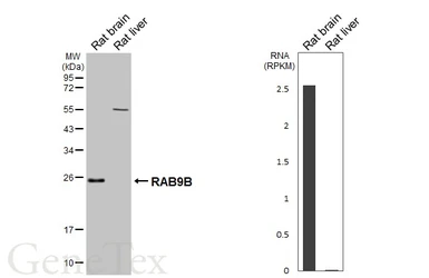 Anti-RAB9B antibody [HL4758] used in Western Blot (WB). GTX644762