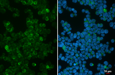 Anti-RAB9B antibody [HL4758] used in Immunocytochemistry/ Immunofluorescence (ICC/IF). GTX644762