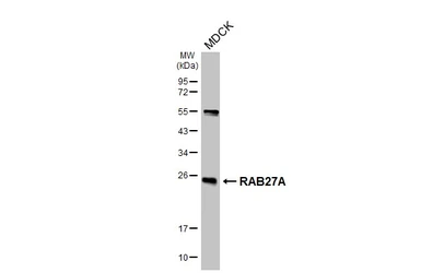 Anti-RAB27A antibody [HL4759] used in Western Blot (WB). GTX644763