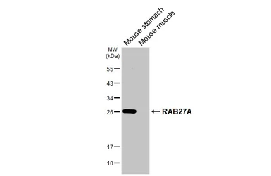 Anti-RAB27A antibody [HL4759] used in Western Blot (WB). GTX644763
