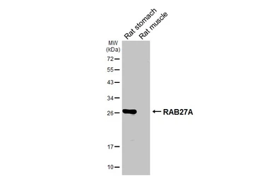 Anti-RAB27A antibody [HL4759] used in Western Blot (WB). GTX644763