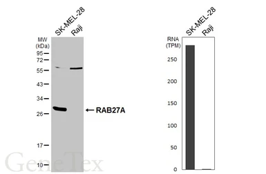 Anti-RAB27A antibody [HL4759] used in Western Blot (WB). GTX644763