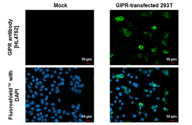Anti-GIPR antibody [HL4762] used in Immunocytochemistry/ Immunofluorescence (ICC/IF). GTX644766