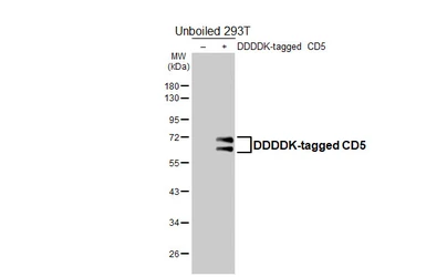 Anti-CD5 antibody [GT269] used in Western Blot (WB). GTX644786
