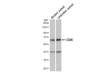 Anti-CD5 antibody [GT269] used in Western Blot (WB). GTX644786