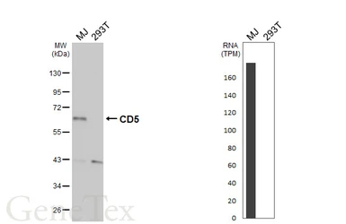 Anti-CD5 antibody [GT269] used in Western Blot (WB). GTX644786