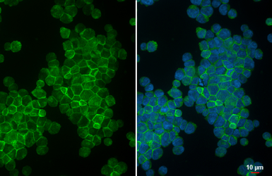 Anti-CD5 antibody [GT269] used in Immunocytochemistry/ Immunofluorescence (ICC/IF). GTX644786