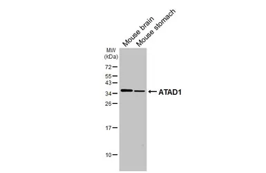 Anti-ATAD1 antibody [GT275] used in Western Blot (WB). GTX644790