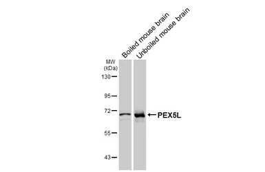 Anti-PEX5L antibody [GT278] used in Western Blot (WB). GTX644791