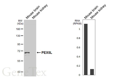 Anti-PEX5L antibody [GT278] used in Western Blot (WB). GTX644791