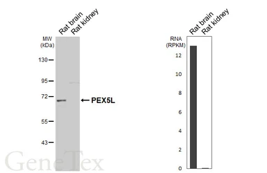 Anti-PEX5L antibody [GT278] used in Western Blot (WB). GTX644791