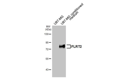 Anti-FLRT2 antibody [HL4784] used in Western Blot (WB). GTX644796
