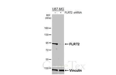 Anti-FLRT2 antibody [HL4784] used in Western Blot (WB). GTX644796