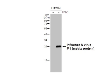 Anti-Influenza A virus M1 (matrix protein) antibody [HL4788] used in Western Blot (WB). GTX644800