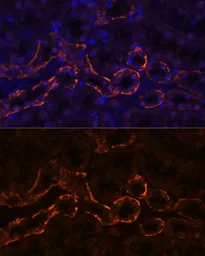 Anti-Aquaporin 3 antibody used in IHC (Paraffin sections) (IHC-P). GTX64481