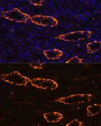 Anti-Aquaporin 3 antibody used in IHC (Paraffin sections) (IHC-P). GTX64481