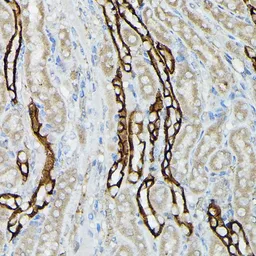 Anti-Aquaporin 3 antibody used in IHC (Paraffin sections) (IHC-P). GTX64481