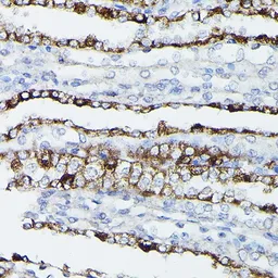 Anti-Aquaporin 3 antibody used in IHC (Paraffin sections) (IHC-P). GTX64481