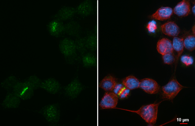 Anti-Aurora B antibody [HL4798] used in Immunocytochemistry/ Immunofluorescence (ICC/IF). GTX644810