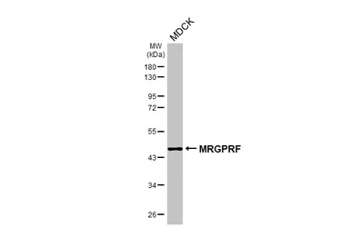 Anti-MRGPRF antibody [HL4802] used in Western Blot (WB). GTX644814