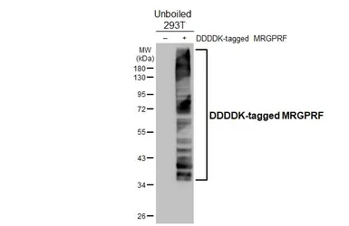 Anti-MRGPRF antibody [HL4802] used in Western Blot (WB). GTX644814