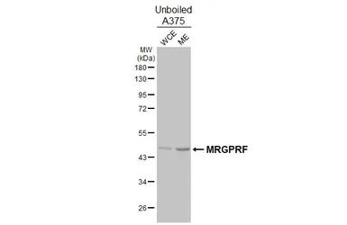 Anti-MRGPRF antibody [HL4802] used in Western Blot (WB). GTX644814