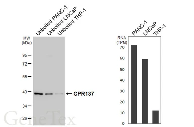 Anti-GPR137 antibody [HL4813] used in Western Blot (WB). GTX644825