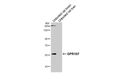 Anti-GPR107 antibody [HL4815] used in Western Blot (WB). GTX644827