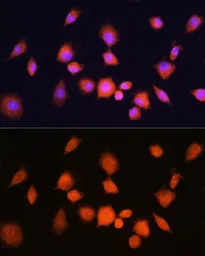 Anti-PGAM1 antibody used in Immunocytochemistry/ Immunofluorescence (ICC/IF). GTX64483