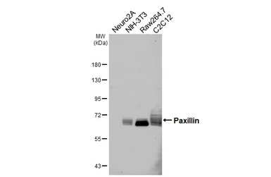 Anti-Paxillin antibody [HL4818] used in Western Blot (WB). GTX644830