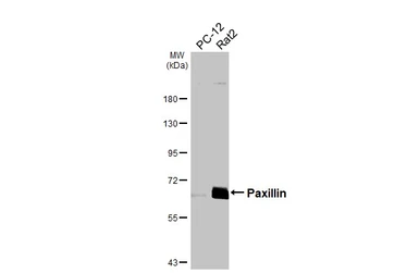 Anti-Paxillin antibody [HL4818] used in Western Blot (WB). GTX644830