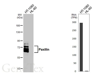 Anti-Paxillin antibody [HL4818] used in Western Blot (WB). GTX644830
