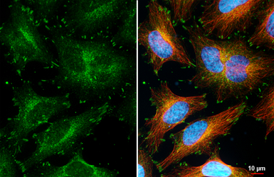 Anti-Paxillin antibody [HL4819] used in Immunocytochemistry/ Immunofluorescence (ICC/IF). GTX644831