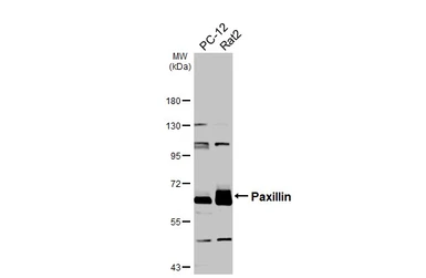Anti-Paxillin antibody [HL4819] used in Western Blot (WB). GTX644831