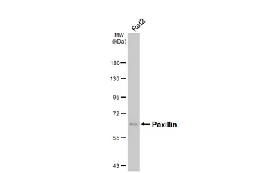 Anti-Paxillin antibody [HL4819] used in Western Blot (WB). GTX644831