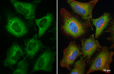 Anti-RPL3 antibody [HL4824] used in Immunocytochemistry/ Immunofluorescence (ICC/IF). GTX644836