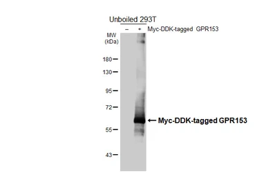 Anti-GPR153 antibody [HL4829] used in Western Blot (WB). GTX644841