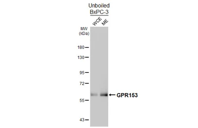 Anti-GPR153 antibody [HL4829] used in Western Blot (WB). GTX644841