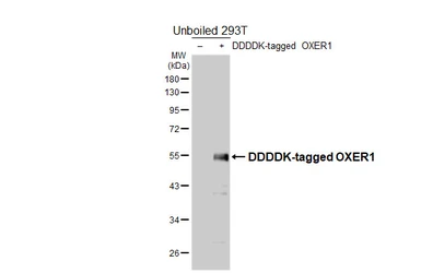 Anti-OXER1 antibody [HL4831] used in Western Blot (WB). GTX644843