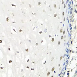 Anti-CNOT8 antibody used in IHC (Paraffin sections) (IHC-P). GTX64486