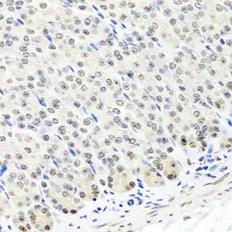 Anti-CNOT8 antibody used in IHC (Paraffin sections) (IHC-P). GTX64486