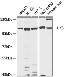 Anti-Hexokinase III antibody used in Western Blot (WB). GTX64487