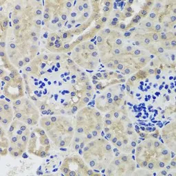 Anti-Hexokinase III antibody used in IHC (Paraffin sections) (IHC-P). GTX64487