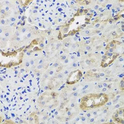 Anti-Hexokinase III antibody used in IHC (Paraffin sections) (IHC-P). GTX64487