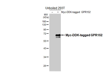 Anti-GPR152 antibody [GT279] used in Western Blot (WB). GTX644891