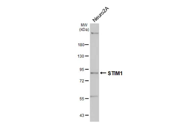 Anti-STIM1 antibody [HL4832] used in Western Blot (WB). GTX644895